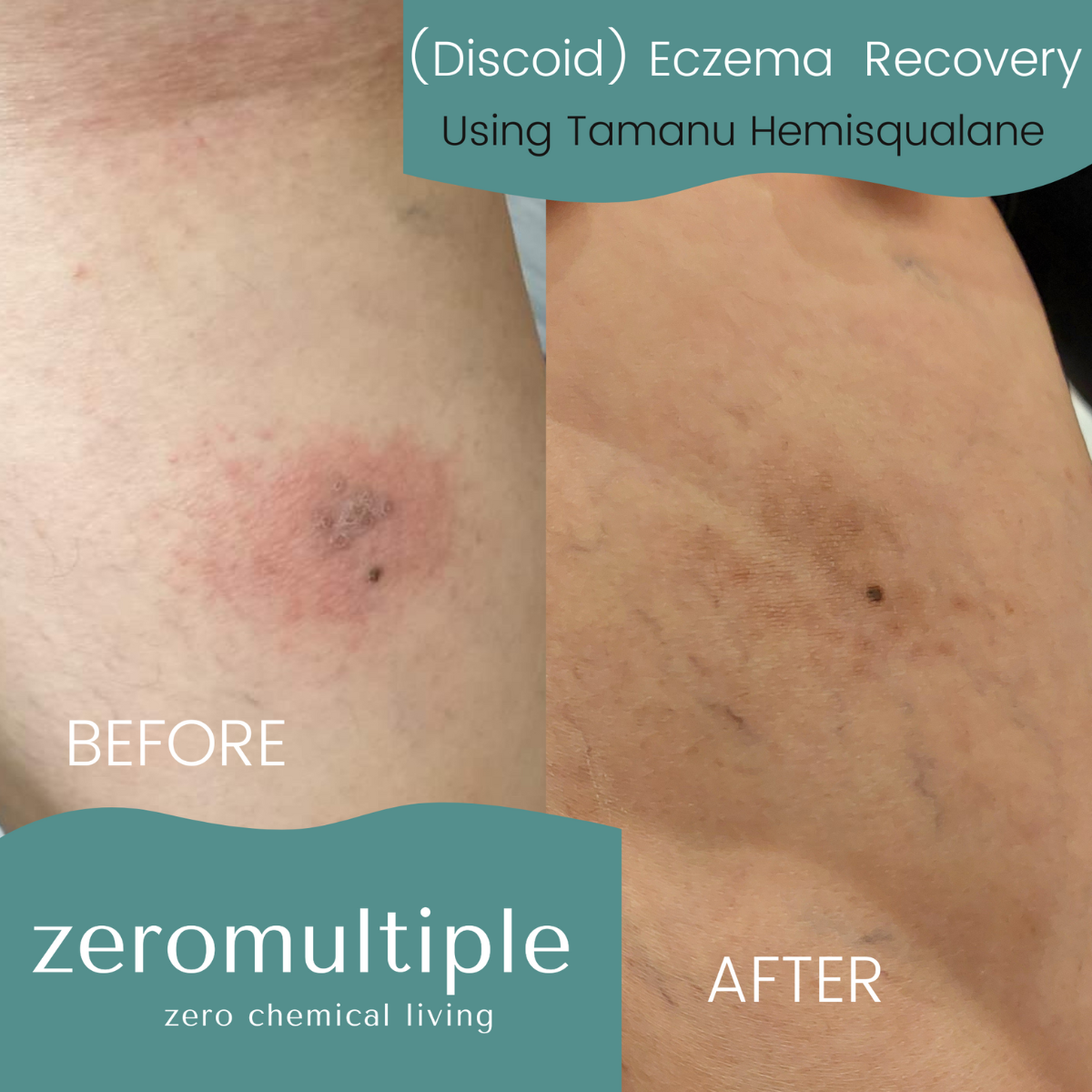 Tamanu Hemisqualane Oil Moisturiser