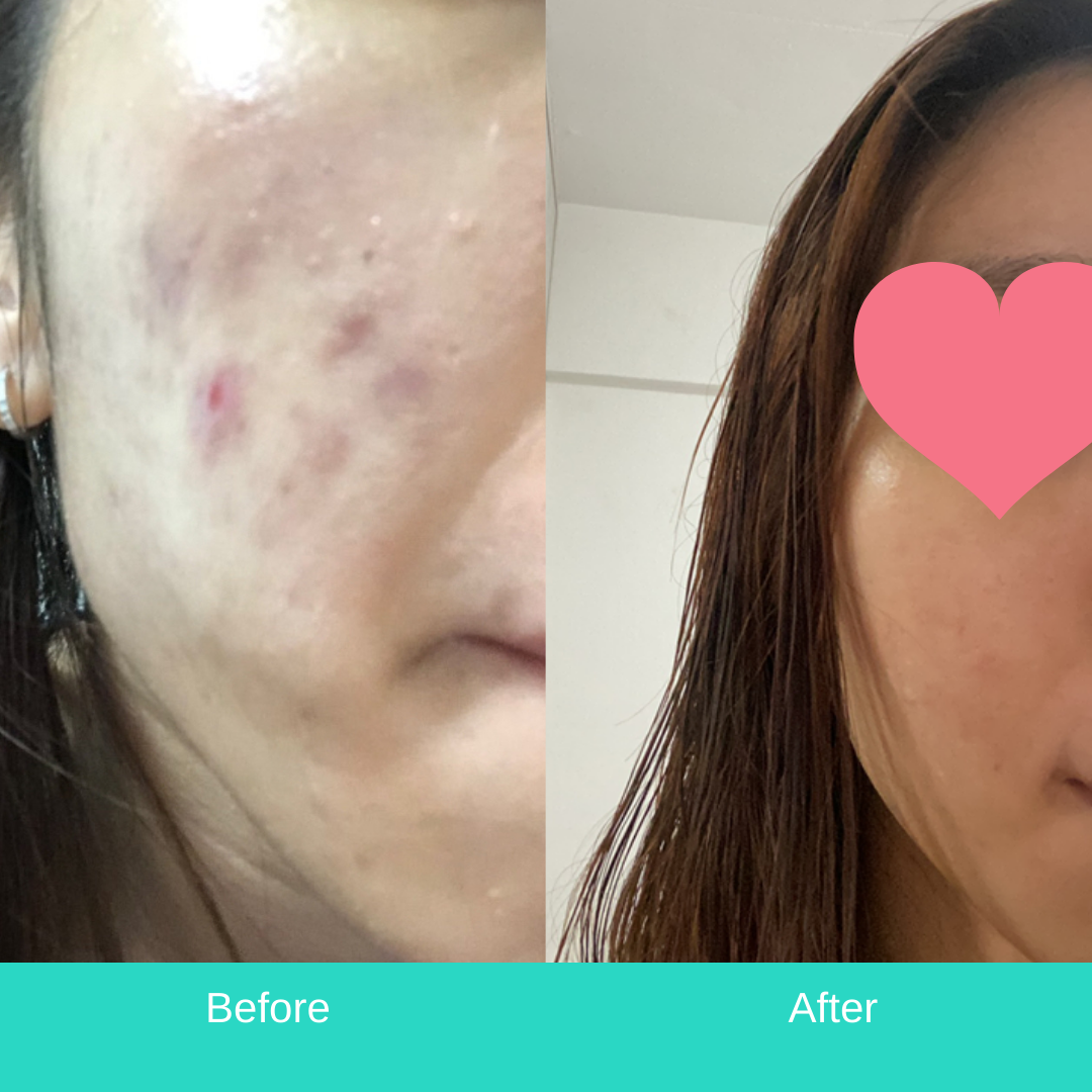 Before & After ( Xiao Jie)